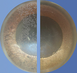 Mikroskopaufnahme: Vorher (links) schwammartige Kalk kann sich festsetzen. Nacher (rechts) festgesetzer Kalk konnte sich lösen
